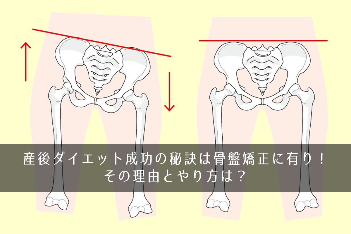 産後ダイエット成功の秘訣は骨盤矯正に有り その理由とやり方は きになるのーと